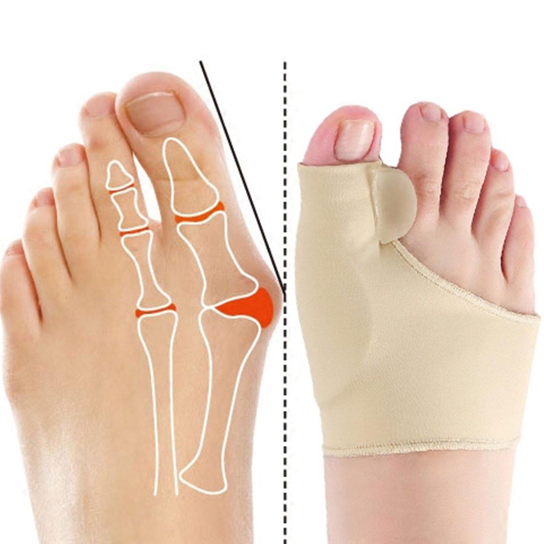 Great toe valgus correction foot guard day and night with the big toe comb orthopaedic care palm cover